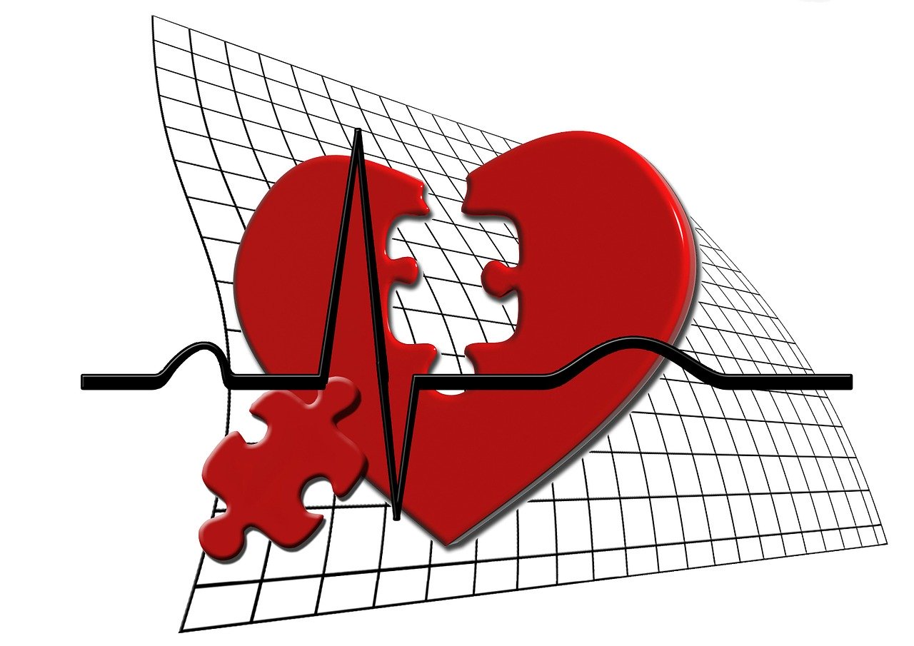 Atrial Fibrillation