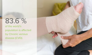 ABI is vitally important in compression therapy