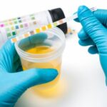 Urine Sample Containers